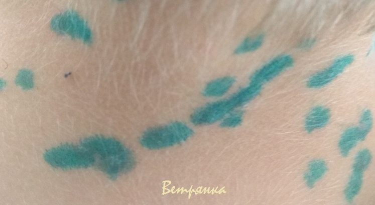 ветрянка у детей симптомы
